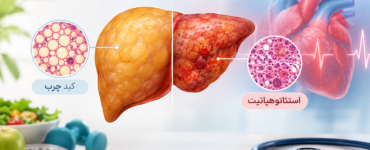تفاوت کبد چرب و استئاتوهپاتیت و ارتباط آن‌ها با سلامت قلب