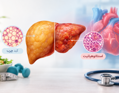 تفاوت کبد چرب و استئاتوهپاتیت و ارتباط آنها با سلامت قلب