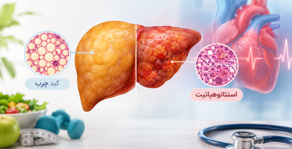 تفاوت کبد چرب و استئاتوهپاتیت و ارتباط آن‌ها با سلامت قلب